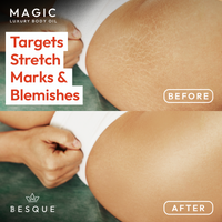 Magic Body Oil - 100ml